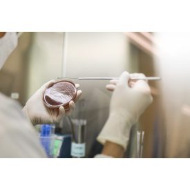 DNS fragmentáció vizsgálat SCSA módszerrel