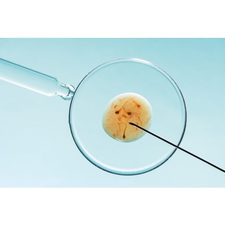 Teljes antioxidáns kapacitás (TAC) meghatározása