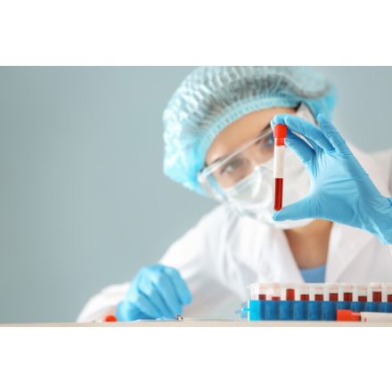 Transzplantációs plusz csomag