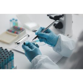 Tumormarker csomag férfiaknak